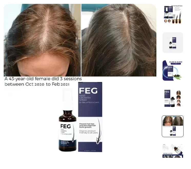 FEG Hair Growth Spray + Derma Rolller Gift For Both Men and Women