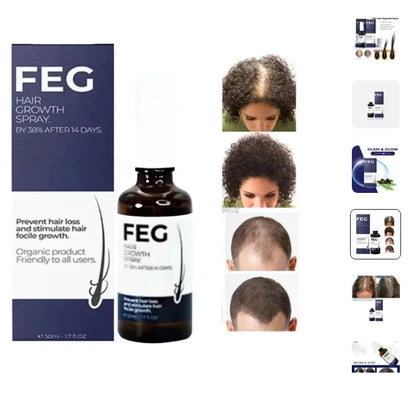FEG Hair Growth Spray + Derma Rolller Gift For Both Men and Women